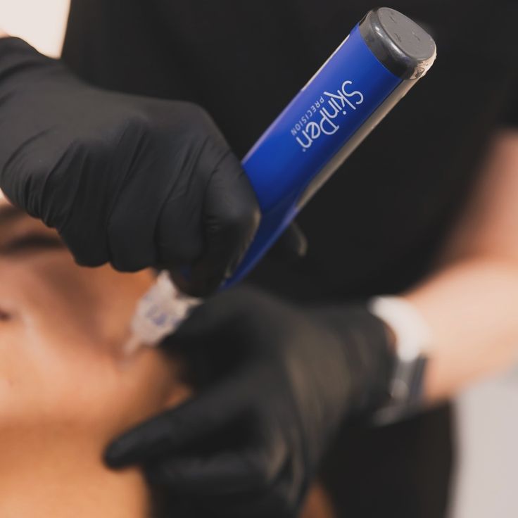 MICRONEEDLING SKINPEN